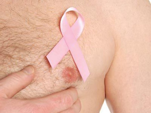 Рак груди у мужчин: стадии развития, характерные симптомы, методы обследования и лечения