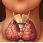 Рак щитовидной железы: классификация видов и причины развития онкологии, разнообразие диагностических процедур в борьбе с болезнью