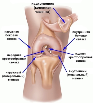 Рассекающий остеохондрит тазобедренного сустава: механизм развития, клинические проявления, диагностика и тактика лечения