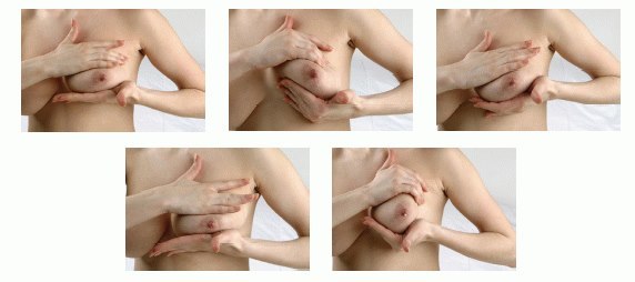 Растяжки на груди: причины появления, сопутствующие проявления, методы избавления и меры профилактики
