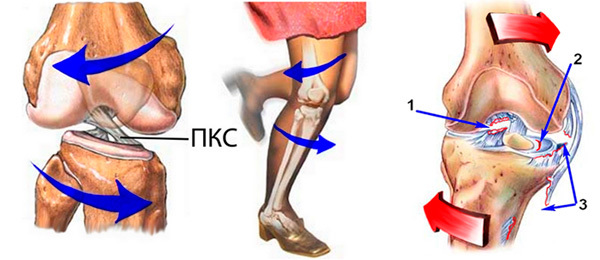 Разрыв связок коленного сустава: степени тяжести, диагностика и особенности лечения, реабилитация