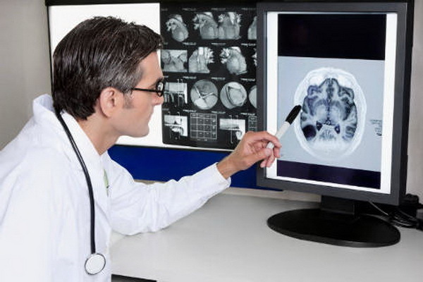 Рентген и КТ головы при головных болях: проведение процедуры, ее преимущества и недостатки