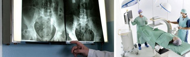 Рентген кишечника: плюсы и минусы исследования, рекомендации по подготовке, алгоритм проведения