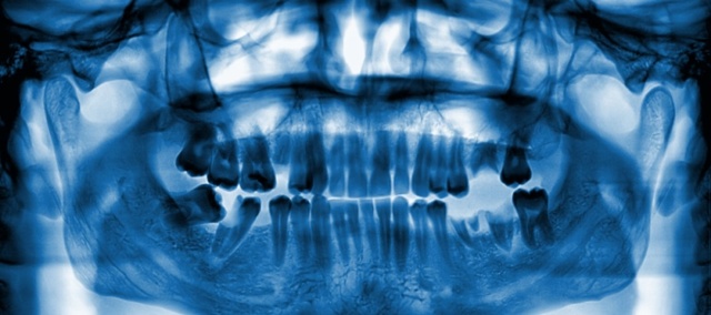 Рентген зубов: вредно или нет при беременности, показания к проведению, оптимальные сроки