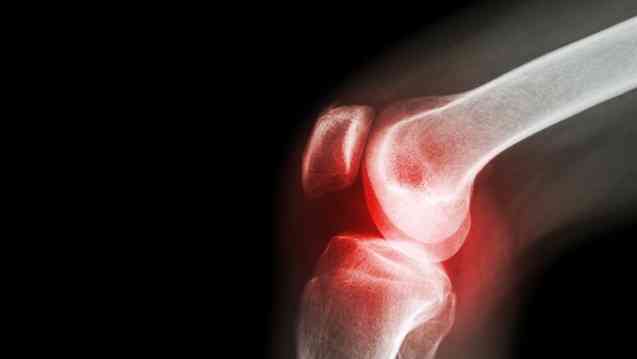 Ревматоидный, подагрический и инфекционный артрит суставов – симптомы и лечение заболевания