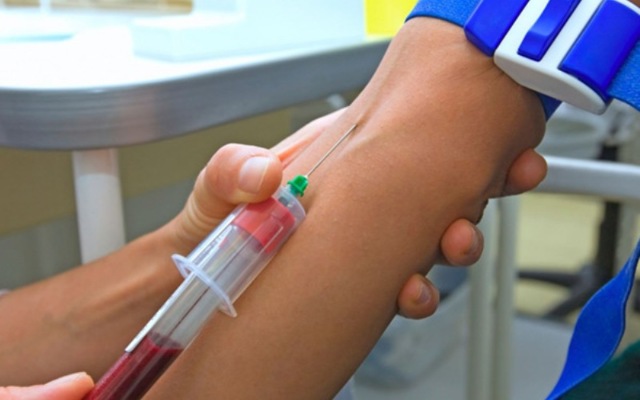 Ревмопробы: нормы и расшифровка, как сдавать анализ крови на ревмопробы