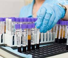 Ревмопробы: нормы и расшифровка, как сдавать анализ крови на ревмопробы