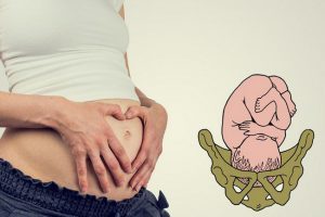 Роды при узком тазе: типы патологии и особенности течения беременности, возможные осложнения при родоразрешении, показания для кесарева сечения