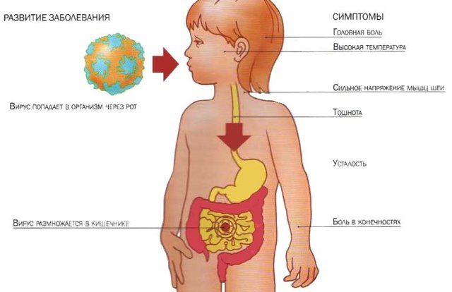 Ротавирусная инфекция: пути передачи, клинические проявления и методы лечения
