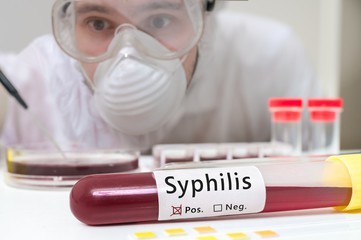 Сифилис (венерическое инфекционное заболевание): как не заразиться, методы предохранения, диагностика и анализы