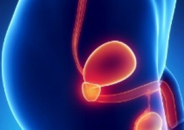 Симптоматика и причины развития аденомы предстательной железы, методы диагностики и лечения заболевания 