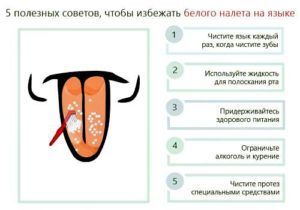 Симптомы заболеваний желчного пузыря: причины боли в правом подреберье, появлении налета на языке, горечи во рту