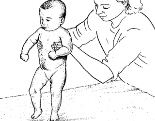 Синдром двигательных нарушений (СДН): у новорожденных детей до года