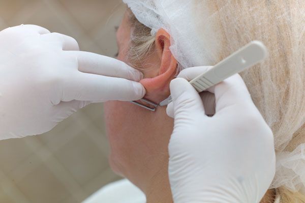 SPRS-терапия: преимущества и недостатки, особенности процедуры, правила проведения омоложения кожи