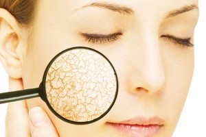 Сухая кожа лица: причины, методы диагностики и лечение ксероза