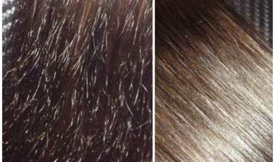 Сухие кончики волос: что делать, маски для сухих кончиков волос в домашних условиях