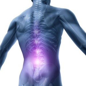 Терапевтические методы лечения остеопороза и лечение народными средствами, симптомы и причины заболевания