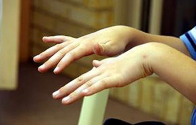 Тремор рук: причины возникновения дрожи, методы диагностики, лечение в домашних условиях