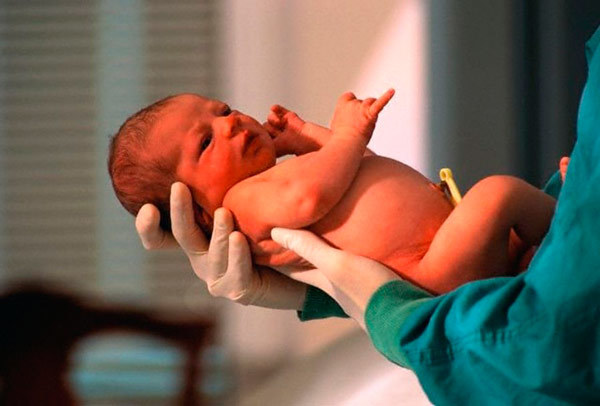 Тремор у новорожденного: почему у новорожденных дрожит подбородок, руки и ноги