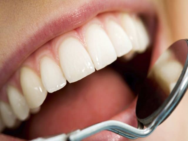Трещины на зубах: причины появления и виды, способы лечения и профилактики