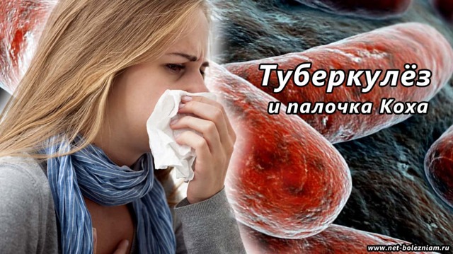 Туберкулез: как проявляется, признаки и профилактика