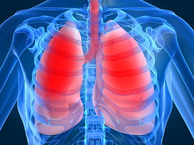 Туберкулез лимфоузлов – что это такое и как проявляется?