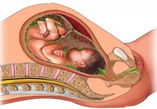Ветрянка при беременности на ранних и поздних сроках: особенности лечения, воздействие на ребенка, меры профилактики