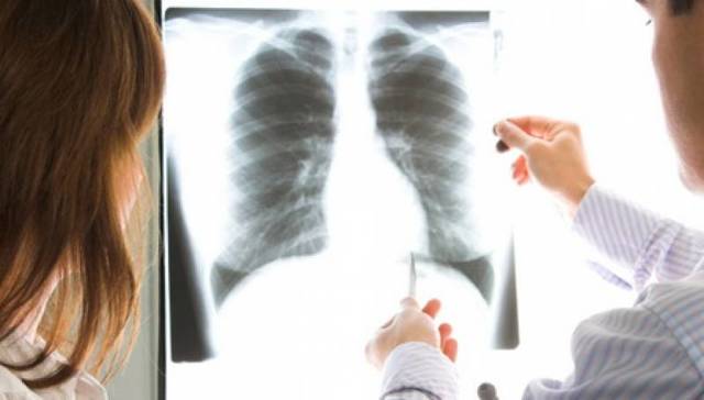 Виден ли туберкулез на флюорографии и какие методы диагностики туберкулеза наиболее эффективны
