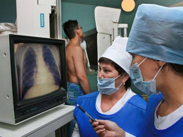 Виден ли туберкулез на флюорографии и какие методы диагностики туберкулеза наиболее эффективны