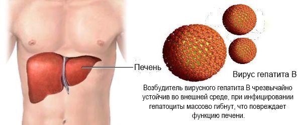 Вирусный гепатит B: источник инфекции, характерные симптомы, необходимые анализы и методы лечения