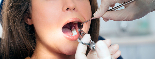 Влияет ли стоматологическая анестезия на сердце?