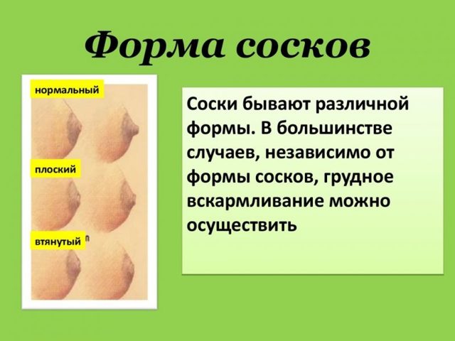 Втянутые соски: коррекция, фото втянутых сосков груди, как кормить при втянутых сосках