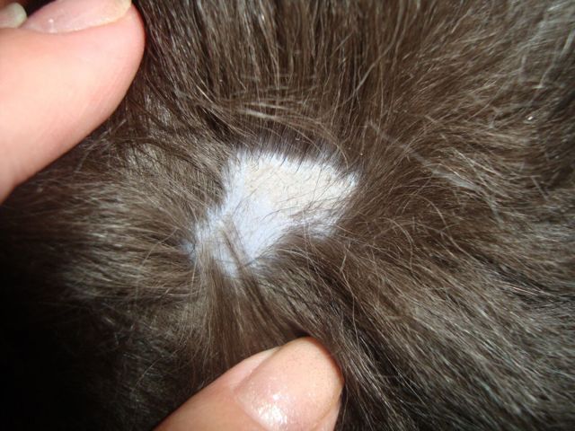 Выпадение волос у мужчин в молодом возрасте: причины и лечение облысения