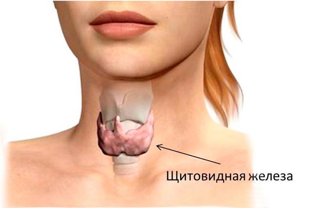 Йододефицитные заболевания щитовидной железы: причины возникновения, симптомы и лечение