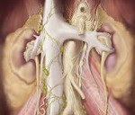 Забрюшиный фиброз, болезнь Ормонда: причины развития, основные симптомы, методы обследования и лечения