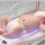 Желтуха новорожденных: причины, лечение, фототерапия, последствия физиологической желтухи 
