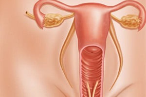 Женский вагинизм: причины проявления, степени и лечение патологии