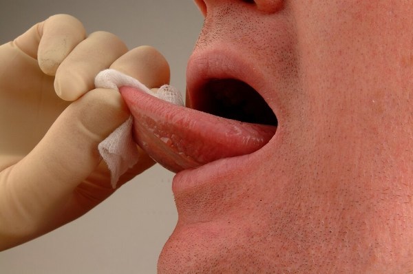 Жжение в горле, во рту и на языке: основные причины, диагностика и тактика лечения, меры профилактики