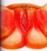 Зуд половых органов: обследования гениталий и возможные причины появления сыпи