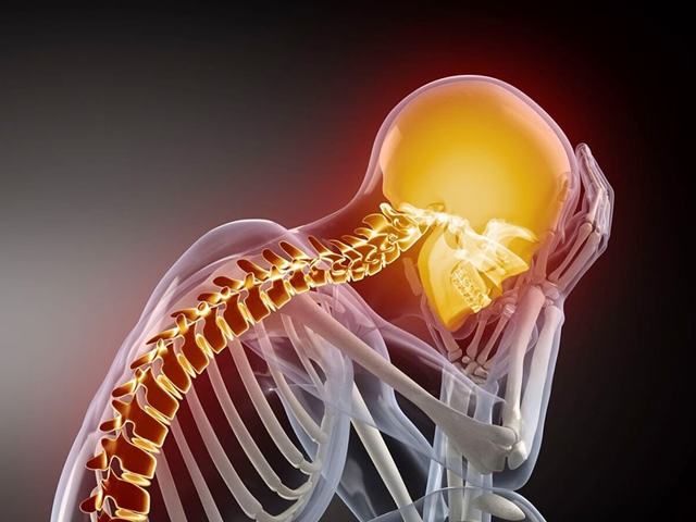 Цервикокраниалгия на фоне шейного остеохондроза: что это такое, особенности диагностики и терапии заболевания, профилактика и рекомендации