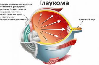 Двоение в глазах: основные причины, симптомы, диагностика и лечение при шейном остеохондрозе