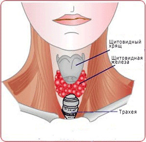 Ком в горле при остеохондрозе шейного отдела: основные причины и симптомы, диагностика болезни и лечение комка