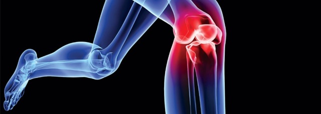 Мениск коленного сустава: что это такое, основные причины, симптомы, диагностика, лечение и профилактические меры
