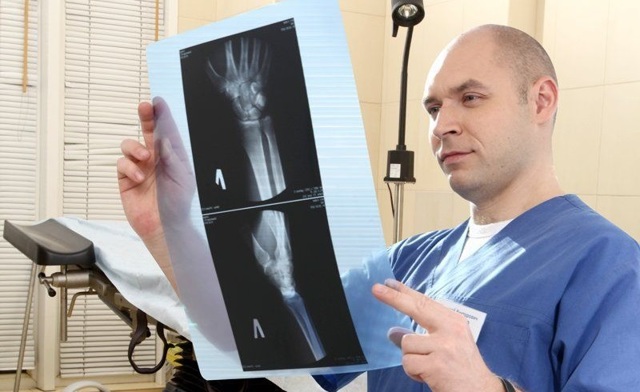 Остеопороз (заболевание скелета): основные причины, симптомы, диагностика и лечение