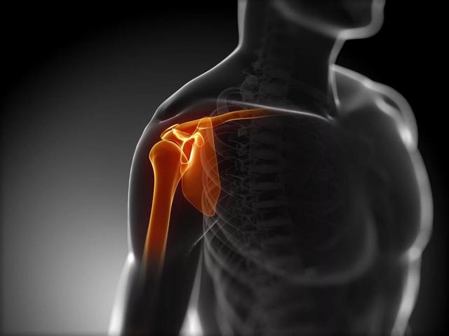 Плечевой остеохондроз: причины появления и развития, симптомы, лечение и профилактика болезни, рекомендации врачей