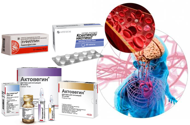Препараты для улучшения мозгового кровообращения при шейном остеохондрозе: список фармакологических продуктов, расширяющих сосуды, рекомендации к выбору, отзывы