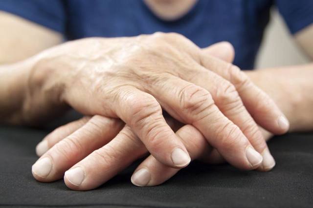Ревматоидный артрит: причины появления, симптомы, диагностика и лечение заболевания