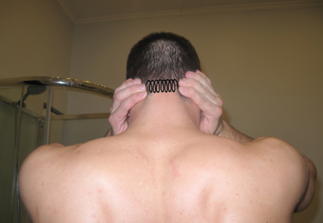 Самомассаж при шейном остеохондрозе: правила и показания, эффективность и преимущества, основные приемы и техники, когда запрещен массаж