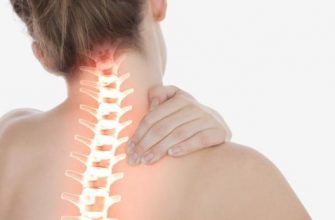 Симптомы и признаки шейного остеохондроза у женщин: причины, как проявляется, диагностика и терапевтические мероприятия, профилактика и рекомендации врачей