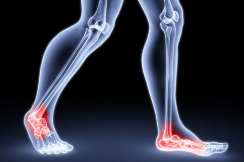 Слабость в ногах и коленях, боли при остеохондрозе: основные причины, симптомы, диагностика и лечение медицинскими и народными средствами